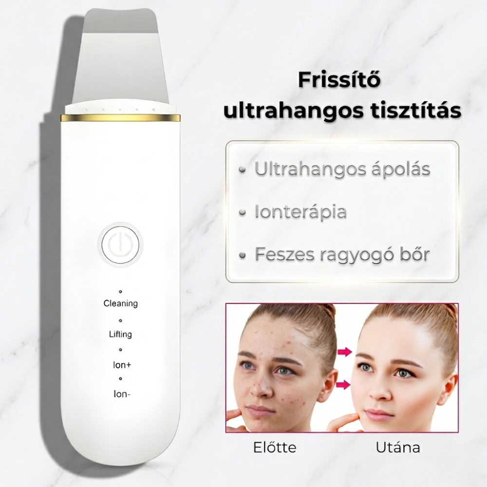 PureGlow-Ultrahangos Arctisztító