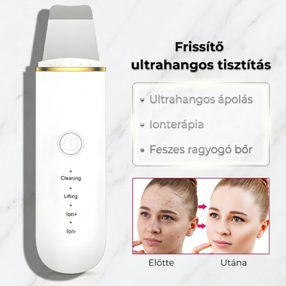 PureGlow-Ultrahangos Arctisztító