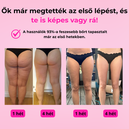 GlowCup-Vákuumos bőrfeszesítő masszírozó